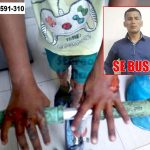Sujeto es denunciado por quemar las manos de su hijastro en Villa El Salvador